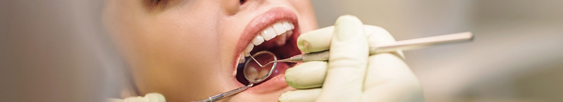Terapinis dantų gydymas