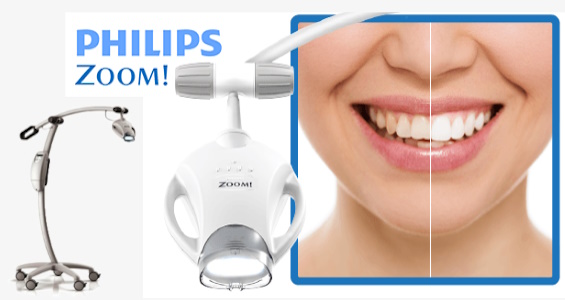 Dantų balinimas su Philips ZOOM sistema